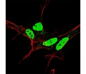 Fluorescent confocal image of SY5Y cells stained with p-NANOG antibody at 1:50. Immunoreactivity is localized very specifically to the nuclei.