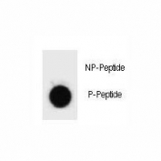 Dot blot analysis of phospho-Caspase-3 antibody. 50ng of phos-peptide or nonphos-peptide per dot were spotted.