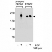 Western blot analysis of extracts from A431 cells, untreated or treated with EGF (100ng/ml) using p-ERBB2 antibody (left) or nonphos Ab (right)