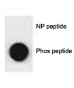 Dot blot analysis of phospho-p62 antibody. 50ng of phos-peptide or nonphos-peptide per dot were spotted.
