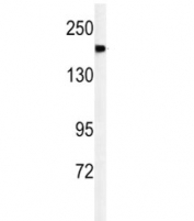 Western blot analysis of A2ML1 antibody and mouse lung tissue lysate. Predicted molecular weight ~161 kDa.