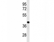 Western blot analysis of ATF1 antibody and human Jurkat lysate. Routinely observed molecular weight: 29-35 kDa.
