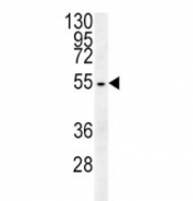 Beta III Tubulin antibody western blot analysis in HepG2 lysate