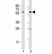 Western blot testing of SOX10 antibody at 1:2000 dilution. Lane 1: C6 lysate; 2: A375 lysate; Predicted molecular weight: 50~58 kDa.