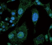 Confocal immunofluorescent analysis of NOTCH3 antibody with HepG2 cells followed by Alexa Fluor 488-conjugated goat anti-rabbit lgG (green). DAPI was used as a nuclear counterstain (blue).