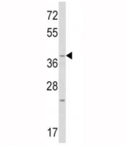 Western blot analysis of WNT1 antibody and mouse heart tissue lysate. Expected/observed molecular weight ~41kDa.