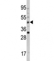 Western blot analysis of AADAC antibody and 293 lysate. Predicted molecular weight ~46 kDa.
