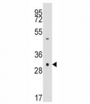 Western blot analysis of anti-Caspase-3 antibody and NCI-H460 lysate.  Expected size ~32 KDa