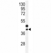 CTGF antibody western blot analysis in mouse bladder tissue lysate. Predicted molecular weight ~38 kDa.