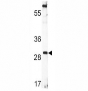 Western blot analysis of BDNF antibody and CEM lysate.