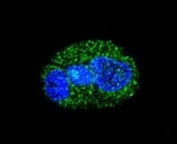 Confocal immunofluorescent analysis of HNF1A antibody with HepG2 cells followed by Alexa Fluor 488-conjugated goat anti-rabbit lgG (green). DAPI was used as a nuclear counterstain (blue).
