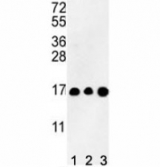 Western blot analysis of HIST3H3 antibody and (1) CEM, (2) K562, and (3) HL-60 lysate