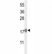Western blot analysis of p21 antibody and HeLa lysate