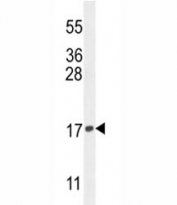 Western blot analysis of Histone H3.3 in K562 lysate