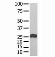 GST Tag antibody used in western blot with recombinant protein