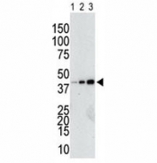 Anti-GST antibody used in western blot to detect a GST-tagged recombinant protein purified from bacterial lysate (Lanes 1-3: 10, 40, and 160 ng protein).