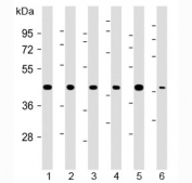 Western blot testing of 1) human 293, 2) (h) HeLa, 3) (h) MDA-MB-231, 4) rat H-4-II-E, 5) (h) HCT-116 and 6) mouse C2C12 cell lysate with TBP antibody at 1:2000. Expected molecular weight: 35-43 kDa.