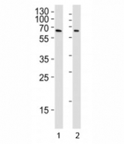 YY1 antibody western blot analysis in Daudi and U251 lysate. Predicted molecular weight 68/40 kDa.