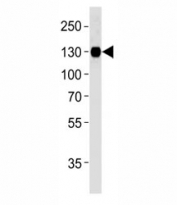 Integrin beta 1 antibody western blot analysis in U87-MG lysate. Predicted molecular weight: 88/130~150 kDa (unmodified/glycosylated).
