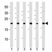 Western blot analysis of lysate from 1) HeLa, 2) 293, 3) HT-1080, 4) Raji, 5) SH-SY5Y and 6) THP-1 cell line using BAX antibody at 1:1000.