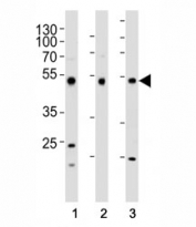 Western blot analysis of lysate from (1) HepG2, (2) HT-29, and (3) SW620 cell line using FOXA2 antibody at 1:1000. Predicted molecular weight: 50 kDa.