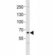 Western blot analysis of lysate from SK-N-MC cell line using PCSK9 antibody at 1:1000. Predicted size: Pro/mature ~74/64 kDa