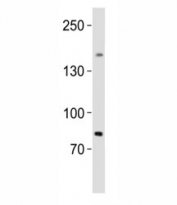 Western blot analysis of lysate from human testis tissue lysate using SALL4 antibody diluted at 1:1000. Predicted molecular weight of isoforms A: 112~165 kDa and B: 65~95 kDa.