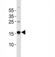 Western blot analysis of lysate from human brain tissue using Map1lc3a antibody diluted at 1:1000.