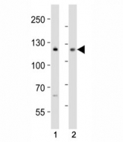 Western blot analysis of lysate from (1) MCF-7 and (2) Jurkat cell line using NOTCH antibody at 1:1000. Predicted molecular weight: ~ 270 kDa (full length), ~ 120 kDa (transmembrane fragment).