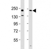 Western blot testing of Erbb2 antibody at 1:2000 dilution. Lane 1: mouse ovary lysate; 2: rat lung lysate; Predicted band size : 139 kDa.