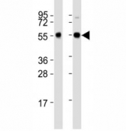 Western blot testing of Beclin-1 antibody at 1:2000 dilution. Lane 1: Zebrafish lysate; 2: ZF4 lysate; Predicted band size : 51 kDa.
