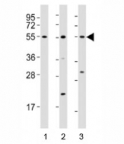 Western blot testing of Runx1 antibody at 1:2000 dilution. Lane 1: Jurkat lysate; 2: NIH3T3 lysate; 3: mouse thymus lysate; Predicted molecular weight: 49 kDa.