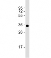 Western blot testing of human recombinant partial protein with BRCA2 antibody at 1:2000.