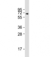 Western blot testing of human placenta lysate with ERVK-7 antibody at 1:1000. Predicted molecular weight: 67 kDa.