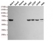 Western blot testing of Vimentin-positive cell lines (Molt-4, K562, COS7, Jurkat, HeLa) and Vimentin-negative cell lines (Daudi, Ramos, Raji) using Vimentin antibody at 1:1000. Predicted molecular weight ~58 kDa.