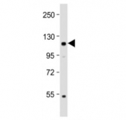 Western blot testing of Kloto antibody at 1:2000 + mouse brain lysate. Predicted molecular weight ~116 kDa, observed at 120-135 kDa.