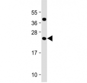 Western blot testing of human testis tissue lysate with FAM3A antibody at 1:2000. Predicted molecular weight ~25 kDa.