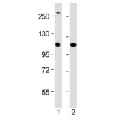 Western blot testing of 1) human SH-SY5Y and 2) mouse Neuro-2a cell lysate with NF-H antibody at 1:2000. Predicted molecular weight ~112 kDa, often visualized at ~200 kDa.