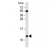 Western blot testing of human heart lysate with NDUFA2 antibody at 1:2000. Predicted molecular weight ~11 kDa.