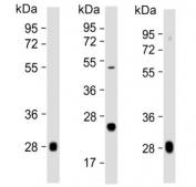 Western blot testing of multiple lots of human plasma lysate with Complement Factor D antibody. Predicted molecular weight: ~27 kDa.