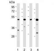 Western blot testing of 1) human PC-3, 2) human U-251 MG, 3) mouse NIH 3T3 and 4) mouse heart lysate with AP1M1 antibody. Predicted molecular weight ~49 kDa.