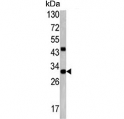 Western blot testing of mouse cerebellum lysate with ZWINT antibody. Predicted molecular weight ~31 kDa.