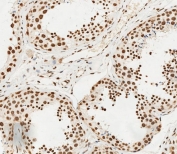 IHC testing of FFPE human testis tissue with HSPA7 antibody. HIER: steam section in pH6 citrate buffer for 20 min and allow to cool prior to staining.