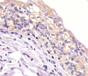 IHC testing of FFPE human bladder tissue with BID antibody. HIER: steam section in pH6 citrate buffer for 20 min and allow to cool prior to staining.
