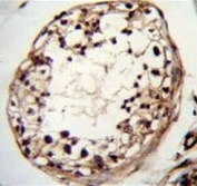 IHC testing of FFPE human testis tissue with TSPYL6 antibody. HIER: steam section in pH6 citrate buffer for 20 min and allow to cool prior to staining.