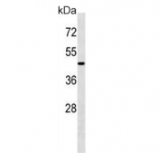 Western blot testing of mouse kidney tissue lysate with ATG4A antibody. Predicted molecular weight ~45 kDa, commonly observed between 45-60 kDa.