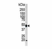 Western blot testing of human HeLa cell lysate with ATG4B antibody. Expected molecular weight: 37-52 kDa (multiple isoforms).