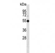 Western blot testing of human Jurkat cell lysate with ATG4C antibody. Predicted molecular weight ~52 kDa.
