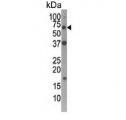 Western blot testing of human Y79 cell lysate with Autophagin 4D antibody. Expected molecular weight: 53-56 kDa.
