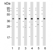 Western blot testing of 1) human HepG2, 2) human HeLa, 3) rat PC-12, 4) human Jurkat, 5) human MCF7 and 6) mouse kidney lysate with p38 MAPK antibody. Expected molecular weight: 38-41 kDa.